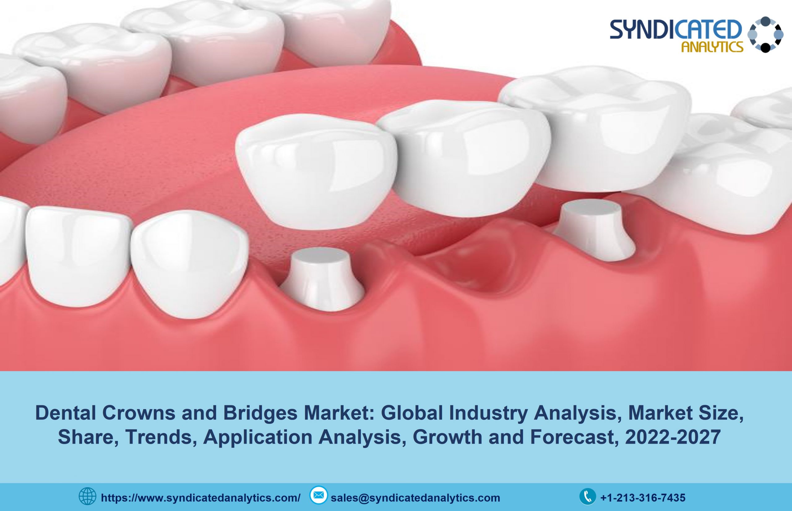 Dental Crowns and Bridges Market